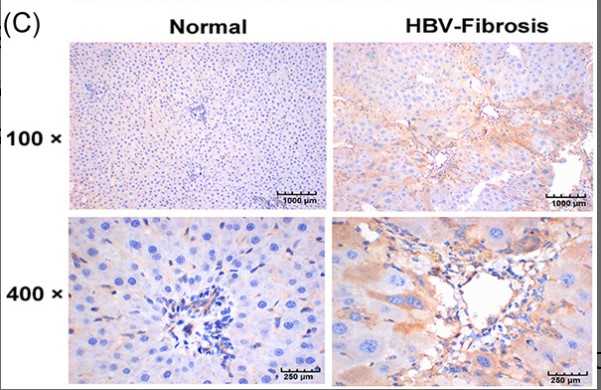Immunohistochemistry detection of CAPN2 protein expression in mouse liver tissues.jpg